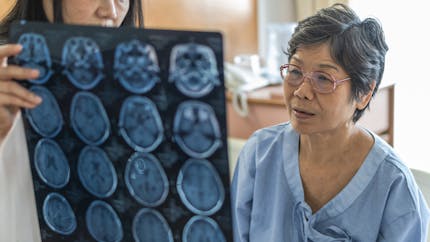 Alzheimer : une seule IRM pourrait suffire à diagnostiquer la maladie