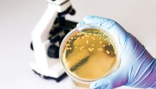 Infection à Escherichia coli : quels symptômes ? comment la soigner ?
