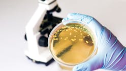 Infection à Escherichia coli : quels symptômes ? comment la soigner ?