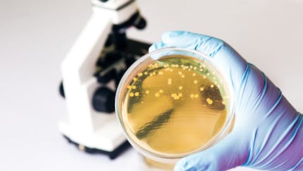 Infection à Escherichia coli : quels symptômes ? comment la soigner ?