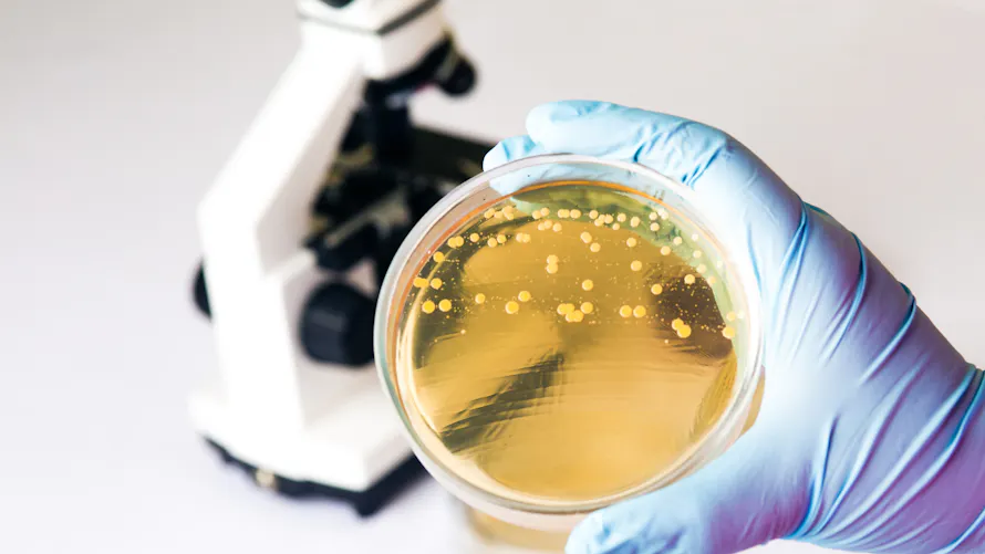 Infection E. coli : tout savoir sur les effets de cette bactrie | Sant Magazine Infection E. coli : tout savoir sur les effets de cette bactrie | Sant Magazine