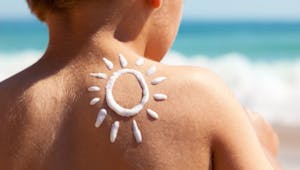 Cancer de la peau : les coups de soleil durant l'enfance directement mis en cause