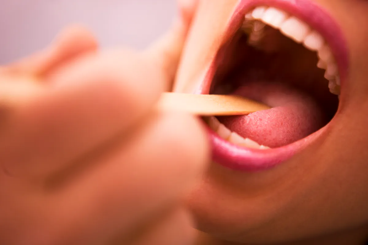Hypersalivation : d'o vient cet excs de salive ? quelles solutions ? | Sant Magazine Hypersalivation : d'o vient cet excs de salive ? quelles solutions ? | Sant Magazine