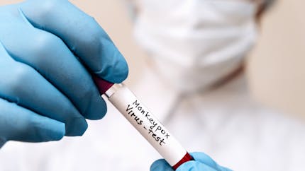 Variole du singe : l’Agence européenne des médicaments autorise une nouvelle technique d’injection du vaccin