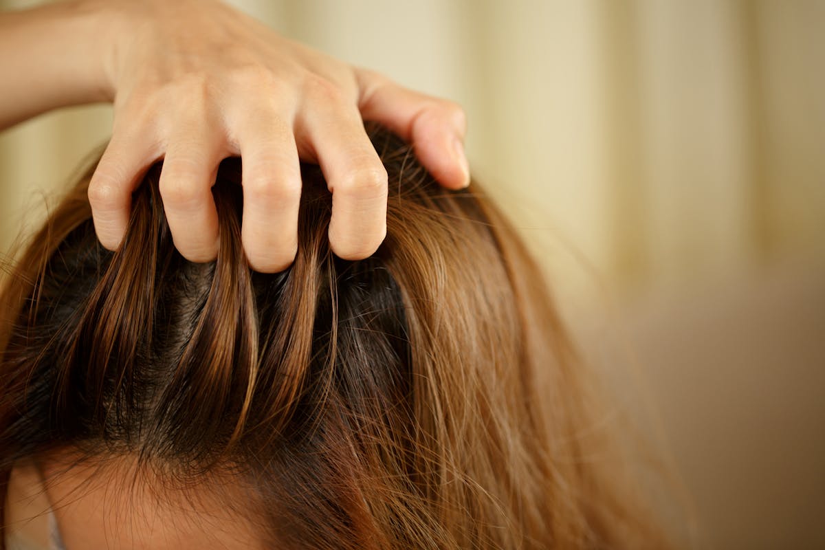 Les raisons de la perte de cheveux chez les enfants et ce qu'il faut faire  pour y remédier