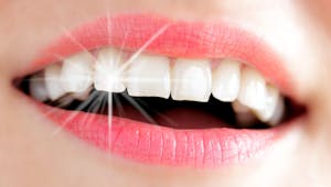 Blanchiment des dents : des produits nocifs selon 60 millions de consommateurs 