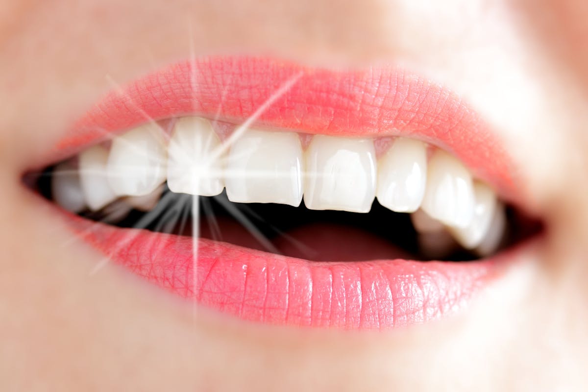 Blanchiment des dents : attention aux produits nocifs ou inutiles !