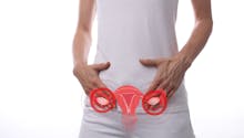 Syndrome des ovaires polykystiques (SOPK) : tout savoir sur ce trouble hormonal