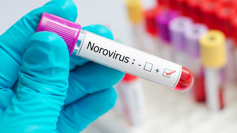 Qu'est-ce qu'un norovirus ? 