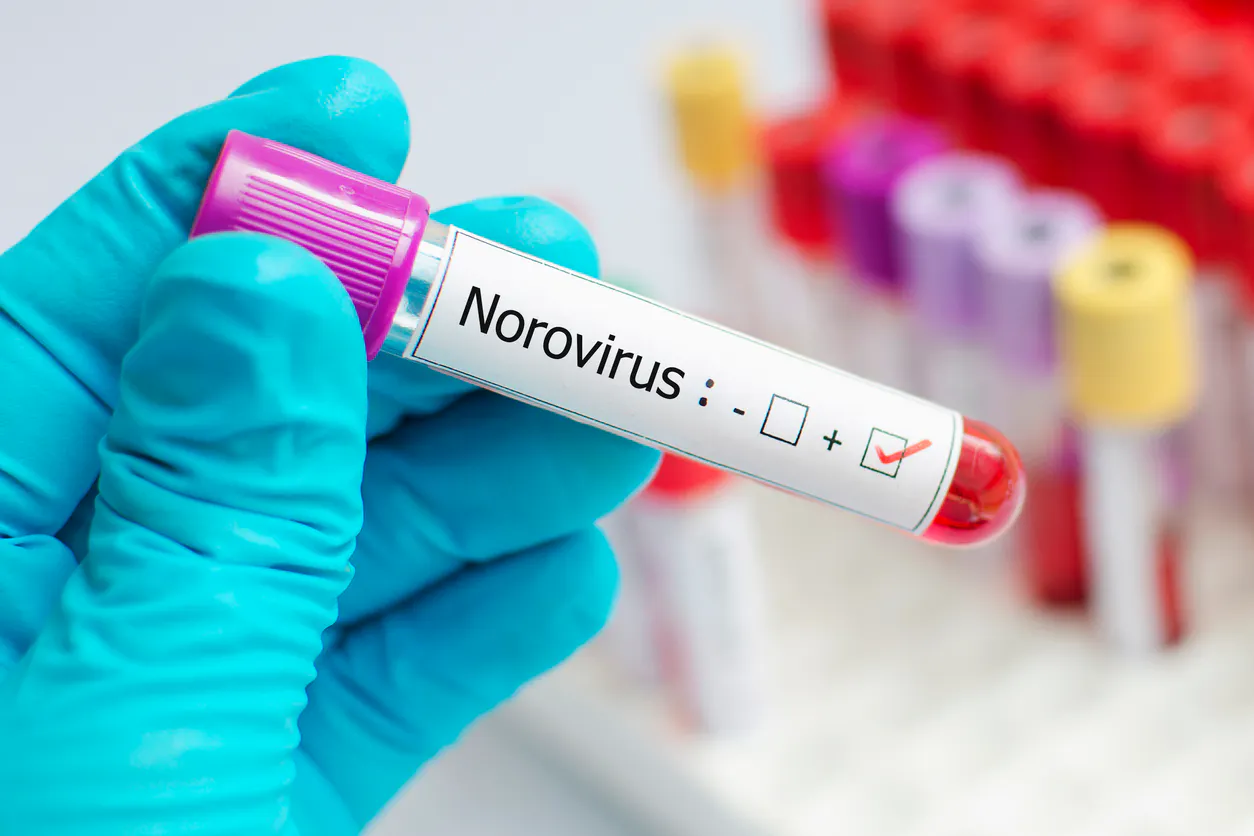 Comment éviter les infections à norovirus, responsables de gastro-entérites virales ?