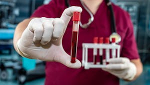 Sang artificiel : un groupe test de volontaires pour les premières transfusions