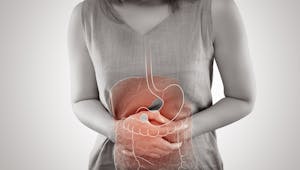 Ulcère digestif : tout savoir sur l'ulcère de l'estomac ou du duodénum
