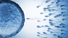 Tératospermie : comment prendre en charge cette affection des spermatozoïdes  ?