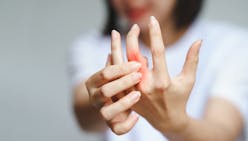 Polyarthrite rhumatoïde : tout savoir sur cette arthrite inflammatoire chronique