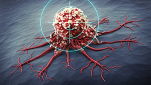 Cancer du poumon : des chercheurs sur le point de trouver de nouveaux traitements
