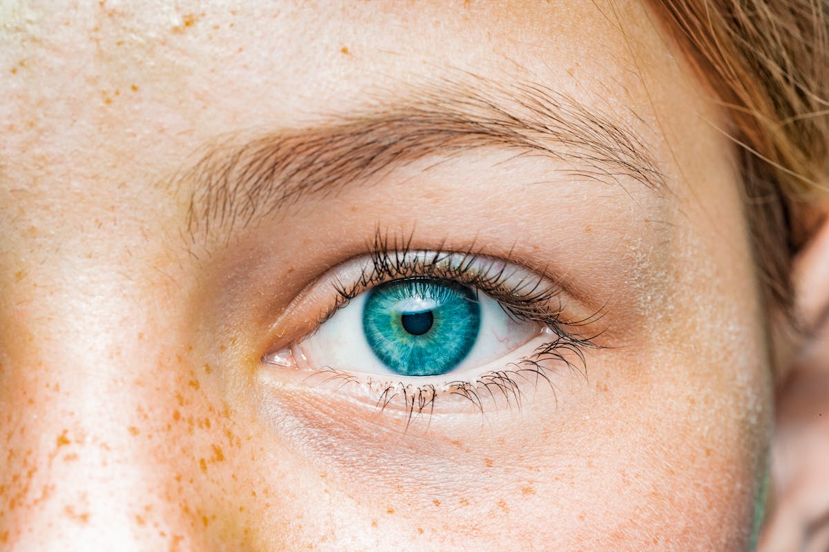 Changer la couleur des yeux est-il sécuritaire ? Kératopigmentation, un  regard