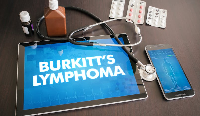 Lymphome de Burkitt : tout comprendre sur ce lymphome agressif
