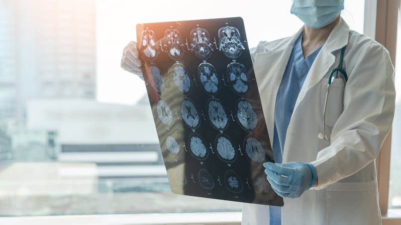 imagerie-IRM-cerveau-maladie-neurologique-neurodegenerative