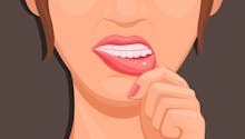 Stomatite : tout savoir sur cette inflammation de la bouche