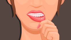 Stomatite : tout savoir sur cette inflammation de la bouche