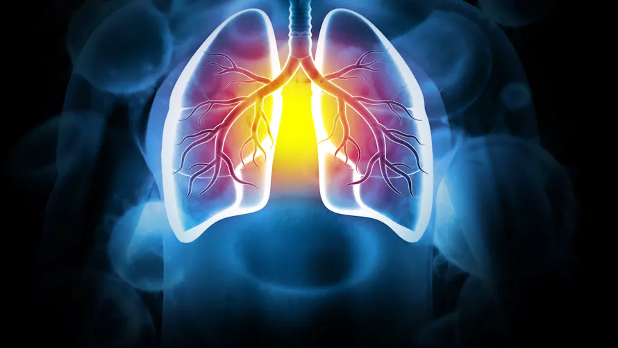 Fibrose pulmonaire : symptmes, traitements, esprance de vie | Sant Magazine Fibrose pulmonaire : symptmes, traitements, esprance de vie | Sant Magazine
