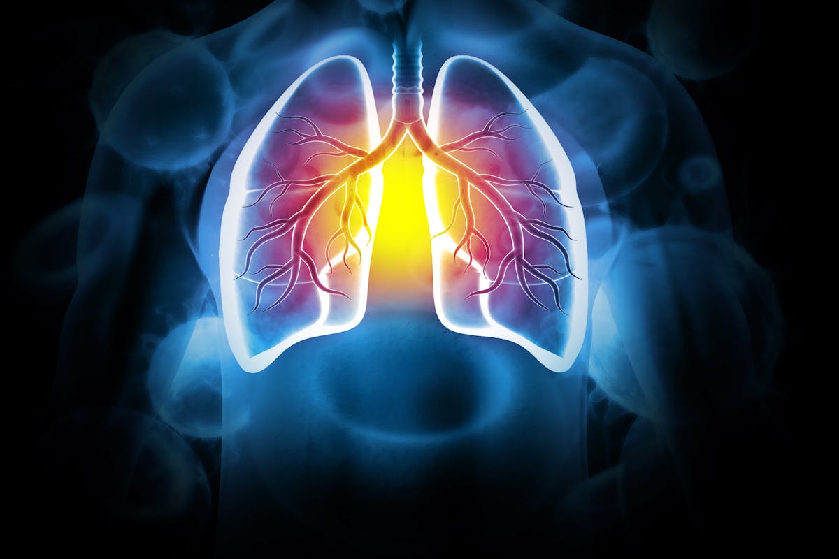 Fibrose pulmonaire : symptômes, traitements, espérance de vie ...