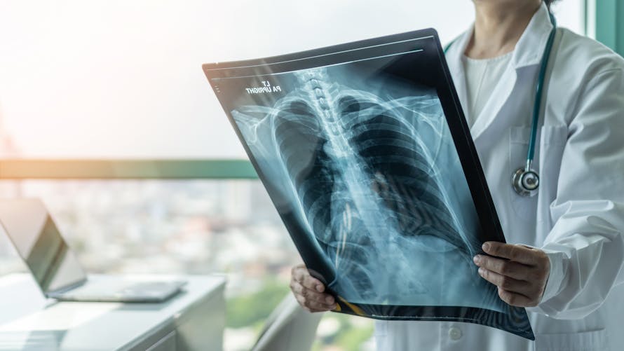 Médecin qui analyse une radiographie des poumons 