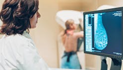 Cancer du sein : la mammographie 3D recommandée par la HAS pour le dépistage