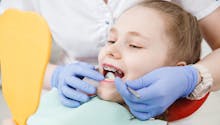 Orthodontie chez l’enfant : à quel âge commencer le traitement ?