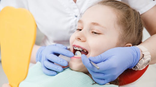 Orthodontie chez l’enfant : à quel âge commencer le traitement ?