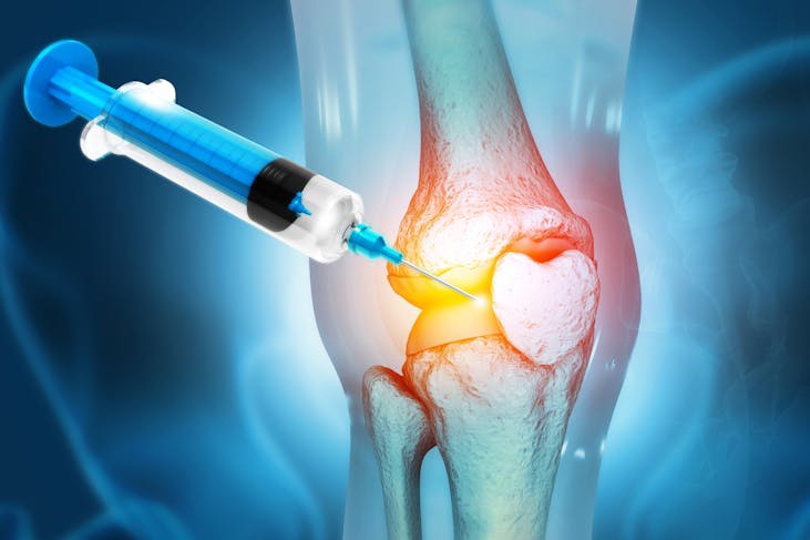 Arthrose du genou : une nouvelle thérapie cellulaire injectable fait ses  preuves