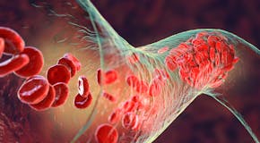 Vasoconstriction : comprendre cette contraction des vaisseaux sanguins