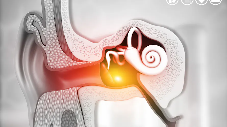 Trompe d’Eustache ouverte ou bouchée : quels traitements ? | Santé Magazine