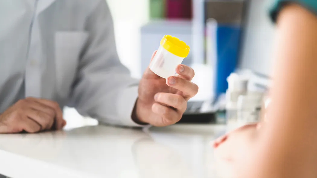 Daurese Rene Diurèse osmotique : définition, causes et symptômes | Santé Magazine