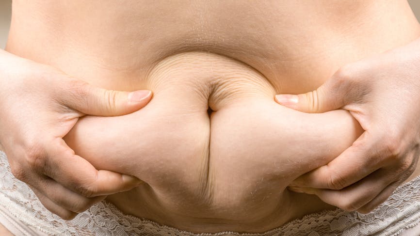 L'obésité androïde est diagnostiquée lorsque l'excès de graisse se situe principalement au niveau du ventre.