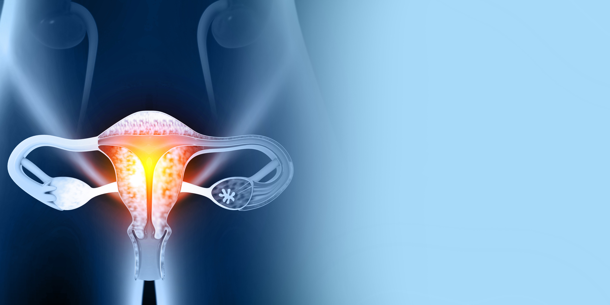 Uterine fibroids and weight gain is there really a link? Archyde