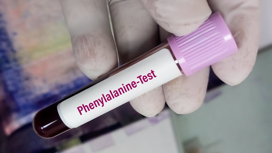 test sanguin de phénylalanine