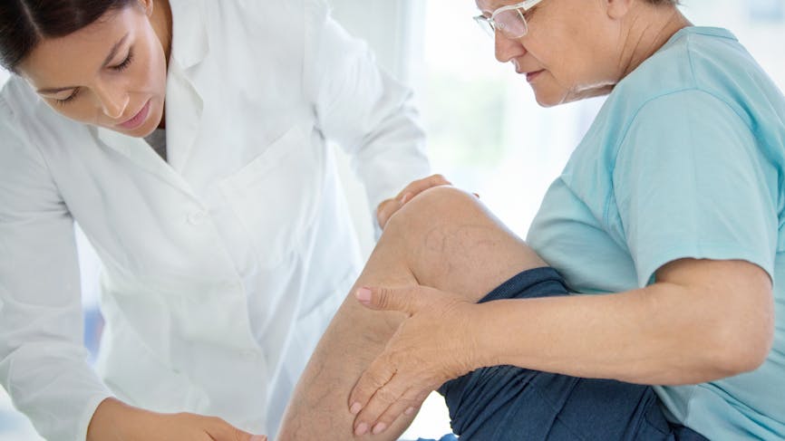 femme médecin qui examine une jambe d'une patiente en surpoids atteinte d'insuffisance veineuse et à risque de phlébite (sa jambe présente des veines apparentes (varicosités))