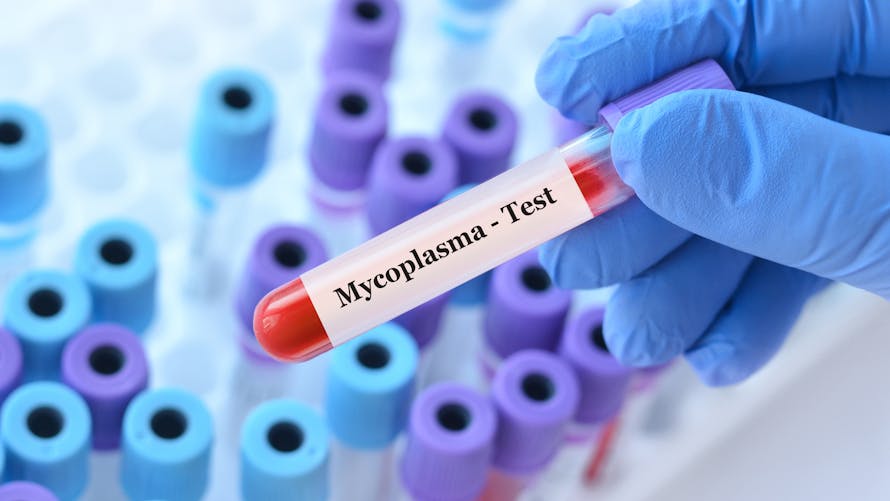 Infection à mycoplasme : transmission, symptômes, traitements | Santé ...