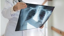 Radiographie pulmonaire : indications, déroulé, résultats