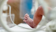 Selon la Haute autorité de Santé, il faut élargir le dépistage néonatal à cette maladie