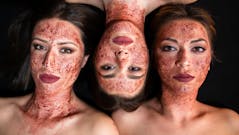 Trois femmes contractent le VIH après un soin du visage “de vampire”