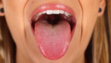 Attention, cette tache blanche sur votre langue peut se transformer en cancer