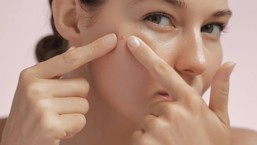 Furoncle sur le visage : causes, faut-il le percer ? | Santé Magazine