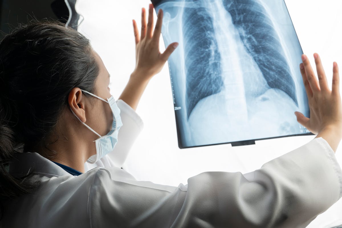 Lung cancer: Find out how a group in France is working to speed up screening