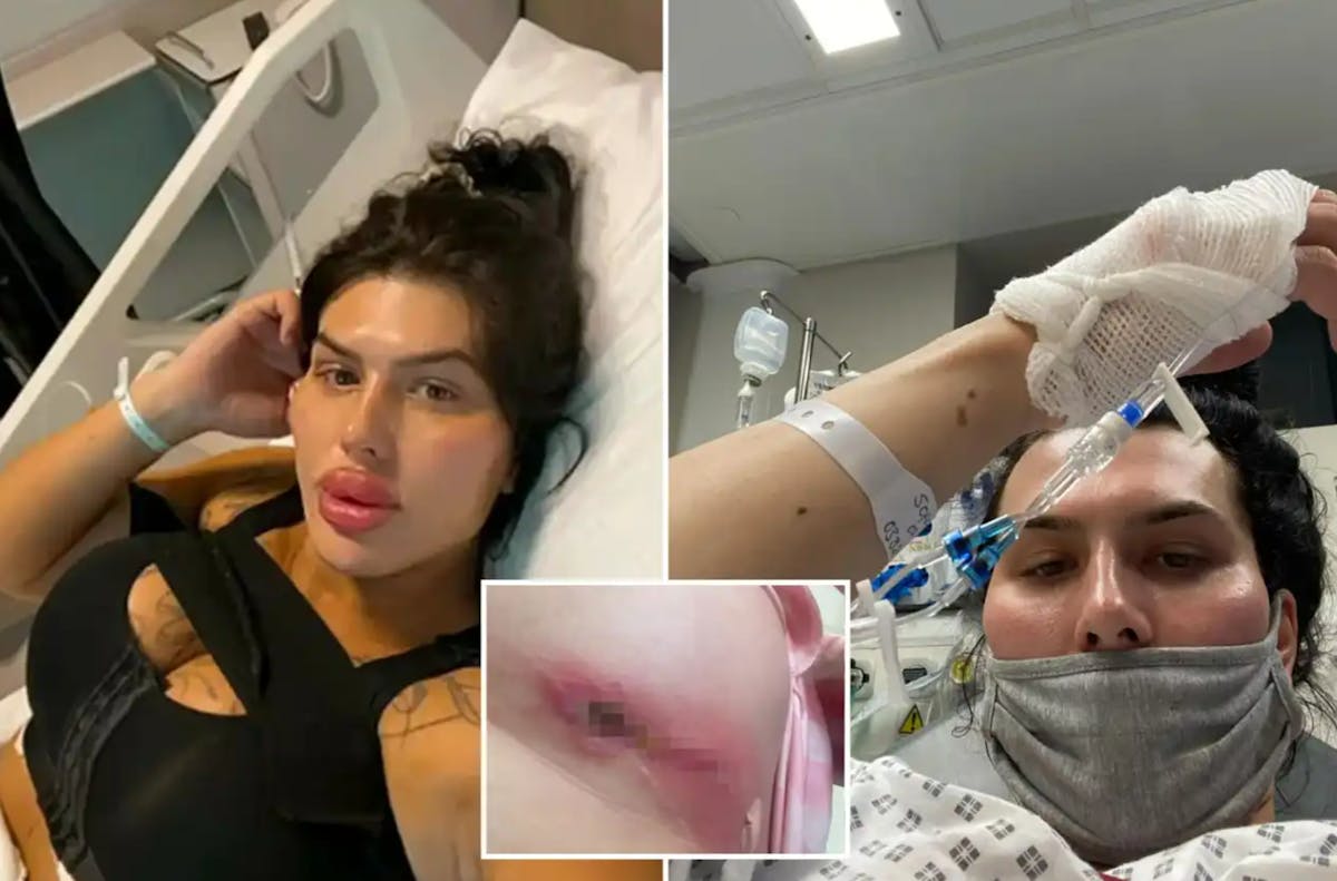 Failed surgery in Türkiye: the ordeal of an influencer