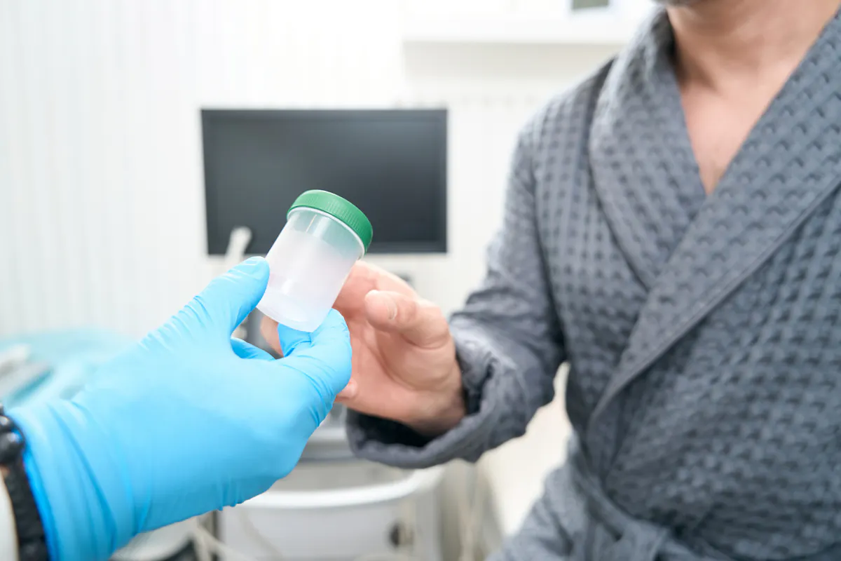 Comment Faire Un Test Urinaire Maison Pour Le Thc