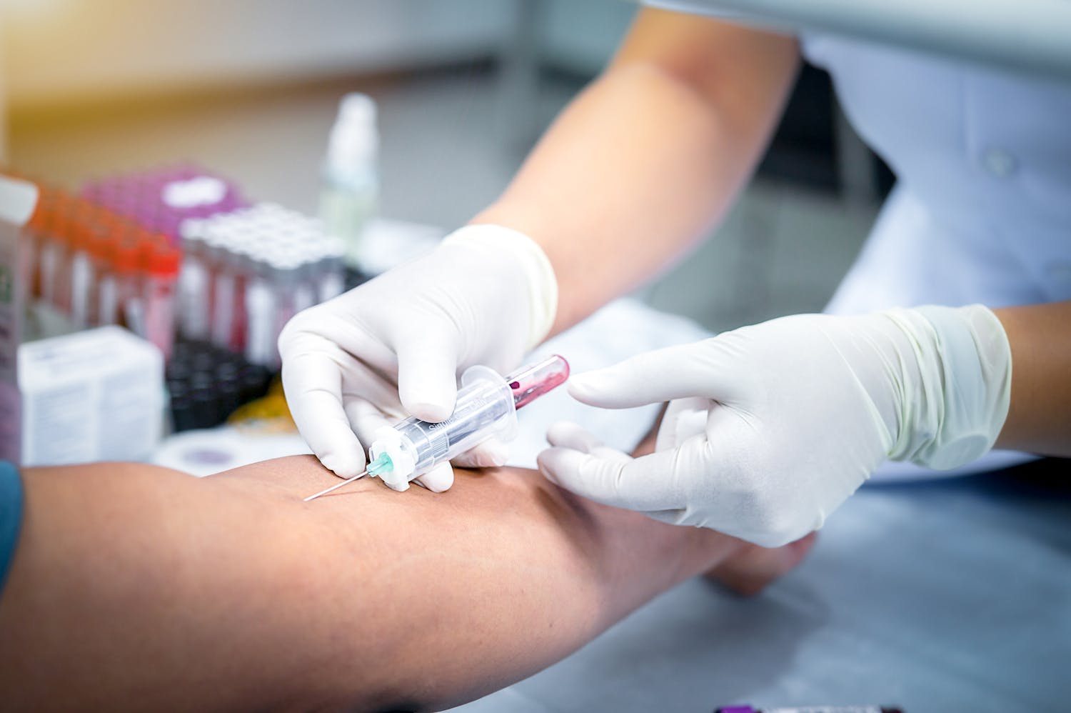 Que révèlent les taux de transaminases sur notre santé ?