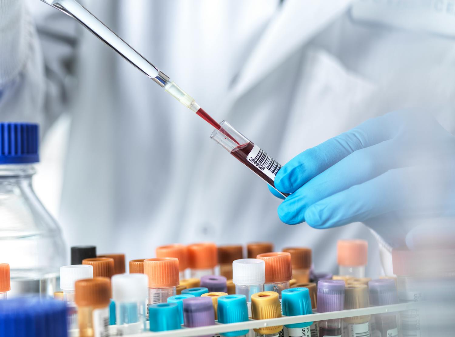 Transfusion sanguine : tout savoir sur les agglutinines irrégulières
