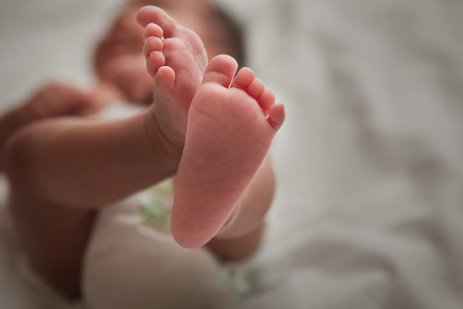 Syndrome du tourniquet : tout savoir sur le syndrome du cheveu étrangleur